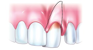 Болит зуб после ударов или травм